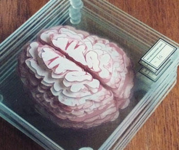Brain Specimen Coasters