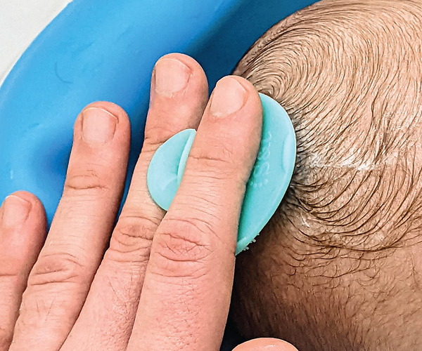Cradle Cap and Baby Head Massager