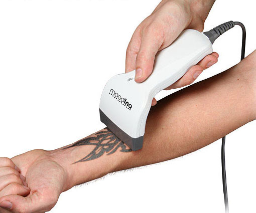Programmable Tattoo System